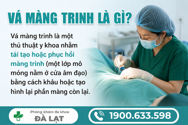 Hình ảnh minh họa